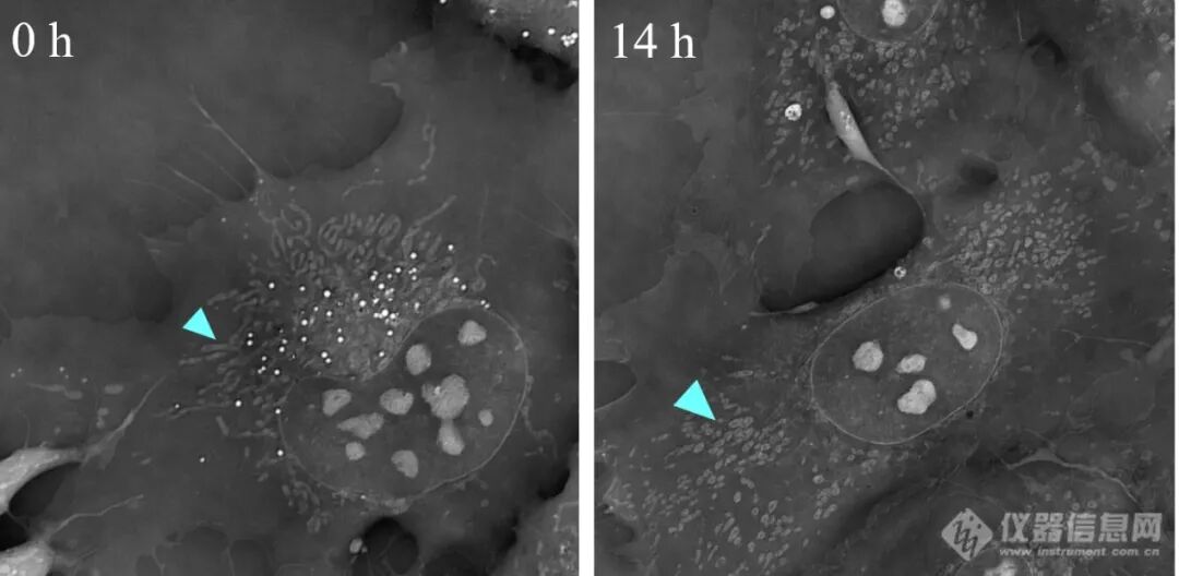 计算光学驱动的新一代显微革命：无标记光强衍射层析赋能活细胞与类器官三维成像