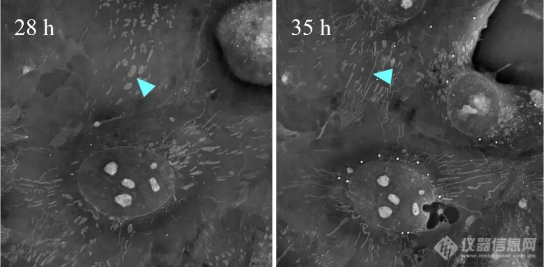 计算光学驱动的新一代显微革命：无标记光强衍射层析赋能活细胞与类器官三维成像