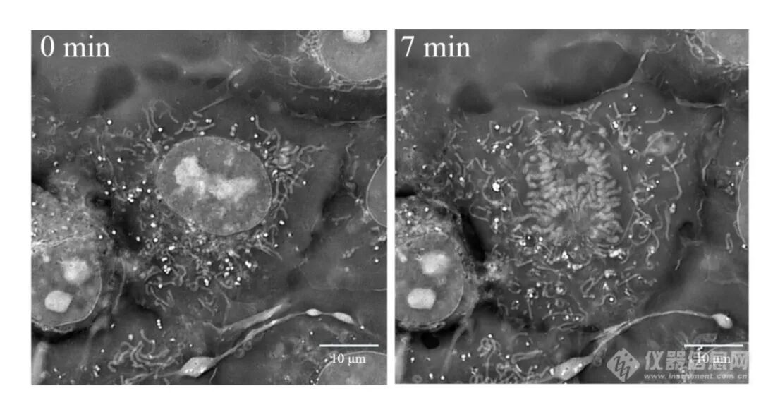 计算光学驱动的新一代显微革命：无标记光强衍射层析赋能活细胞与类器官三维成像
