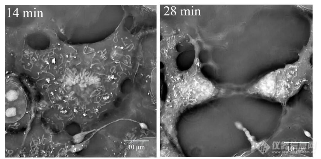 计算光学驱动的新一代显微革命：无标记光强衍射层析赋能活细胞与类器官三维成像