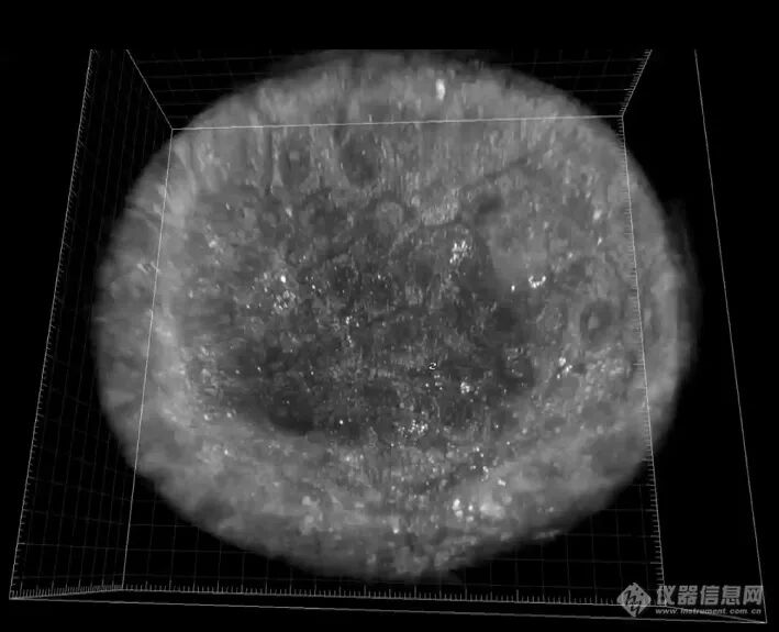 计算光学驱动的新一代显微革命：无标记光强衍射层析赋能活细胞与类器官三维成像