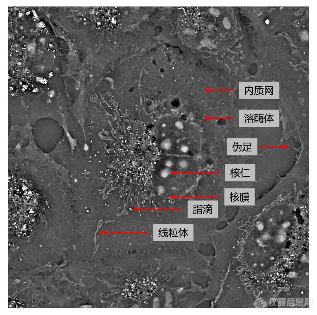 计算光学驱动的新一代显微革命：无标记光强衍射层析赋能活细胞与类器官三维成像