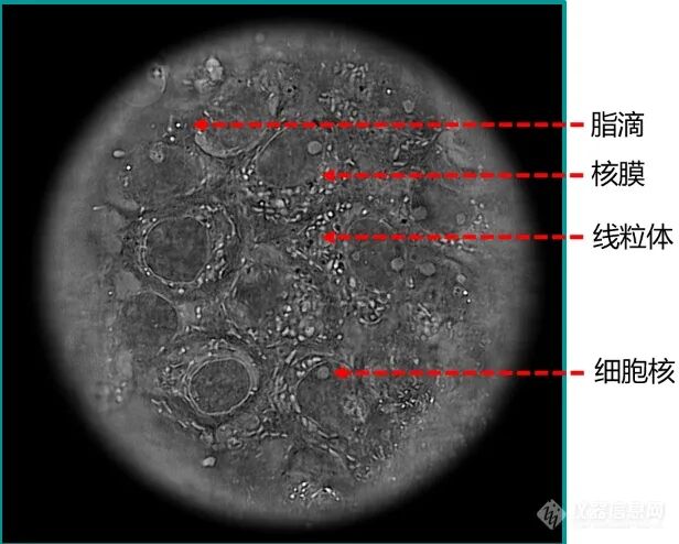 计算光学驱动的新一代显微革命：无标记光强衍射层析赋能活细胞与类器官三维成像